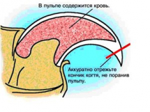 Нерв-кровоток